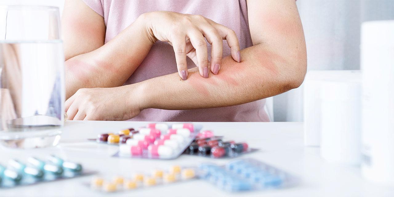 Medikamentenunverträglichkeit Allergie Hautreizung