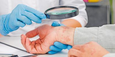 Arzt untersucht mit Lupe Hand eines Patienten