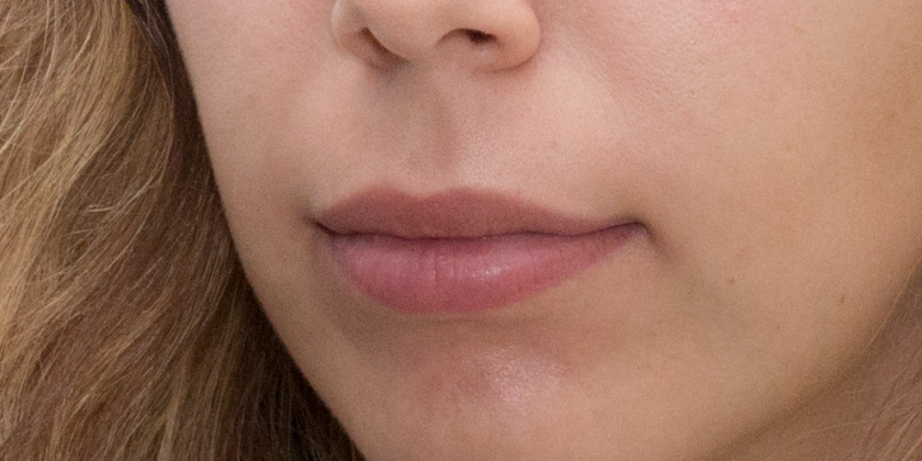 Vorher Aufnahme Detail