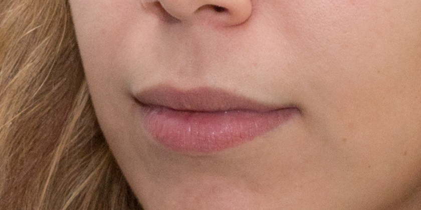 Nachher Aufnahme Detail