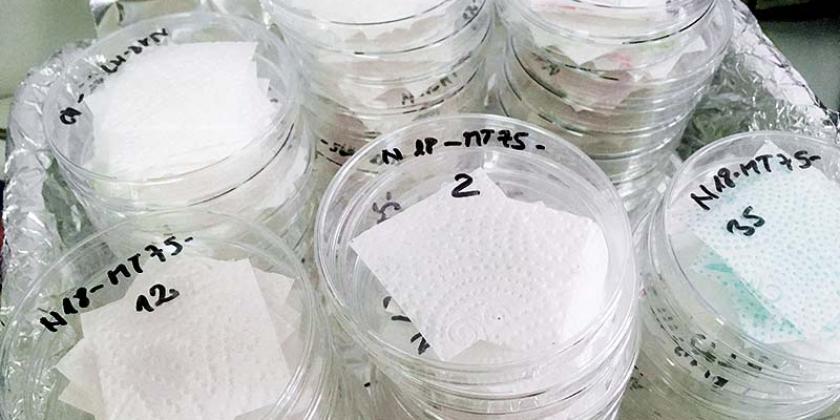 Küchenrollen im Test - Mikrobiologie: Es wurde bestimmt, wie stark das Papier mit Mikroorganismen besiedelt war (Foto: ICRT)