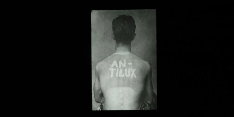 Dieser junge Mann diente Josef Maria Eder und Leopold Freund als Testobjekt für das von ihnen in den 1920ern entwickelte Sonnenschutzmittel Antilux.